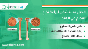 Read more about the article أفضل مستشفى لزراعة نخاع العظم في الهند